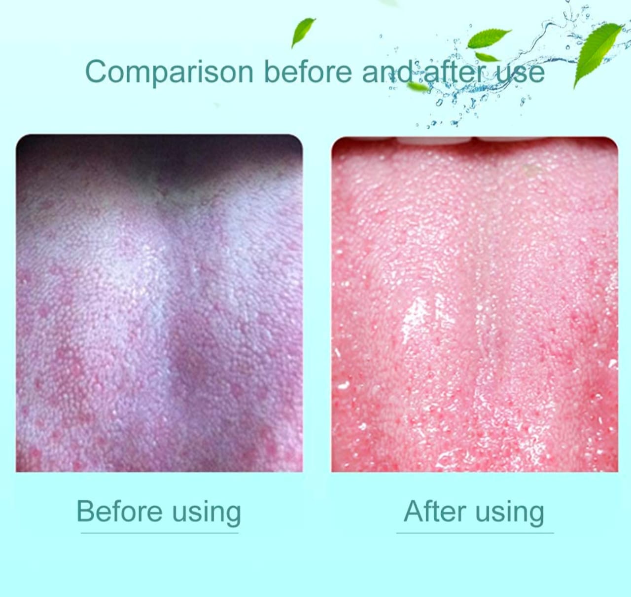 1 Piece Tongue Scraper | Tongue Cleaner | Double Head Tongue Cleaner | Reduce Bad Breath (random color)